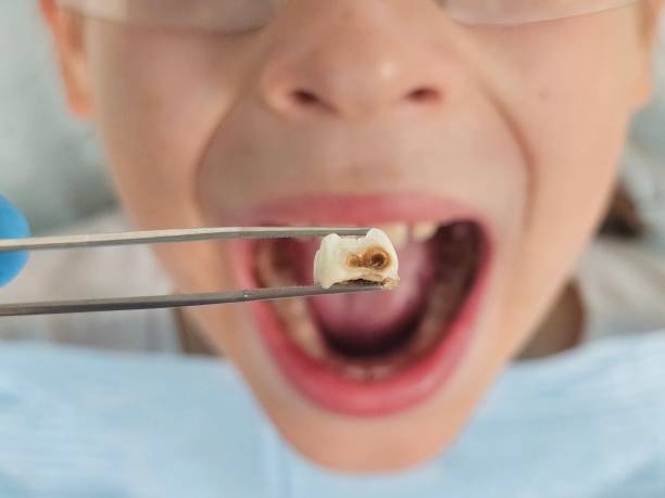 Best Emergency Pediatric Dentist  in Bakerstown, PA